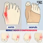 StepFree – Corrector de Juanetes con Gel Interno (1 par)