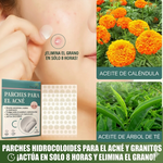 Parche para el acne compra 1 lleva 2 (144 parches)