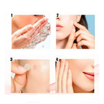 Parche para el acne compra 1 lleva 2 (144 parches)